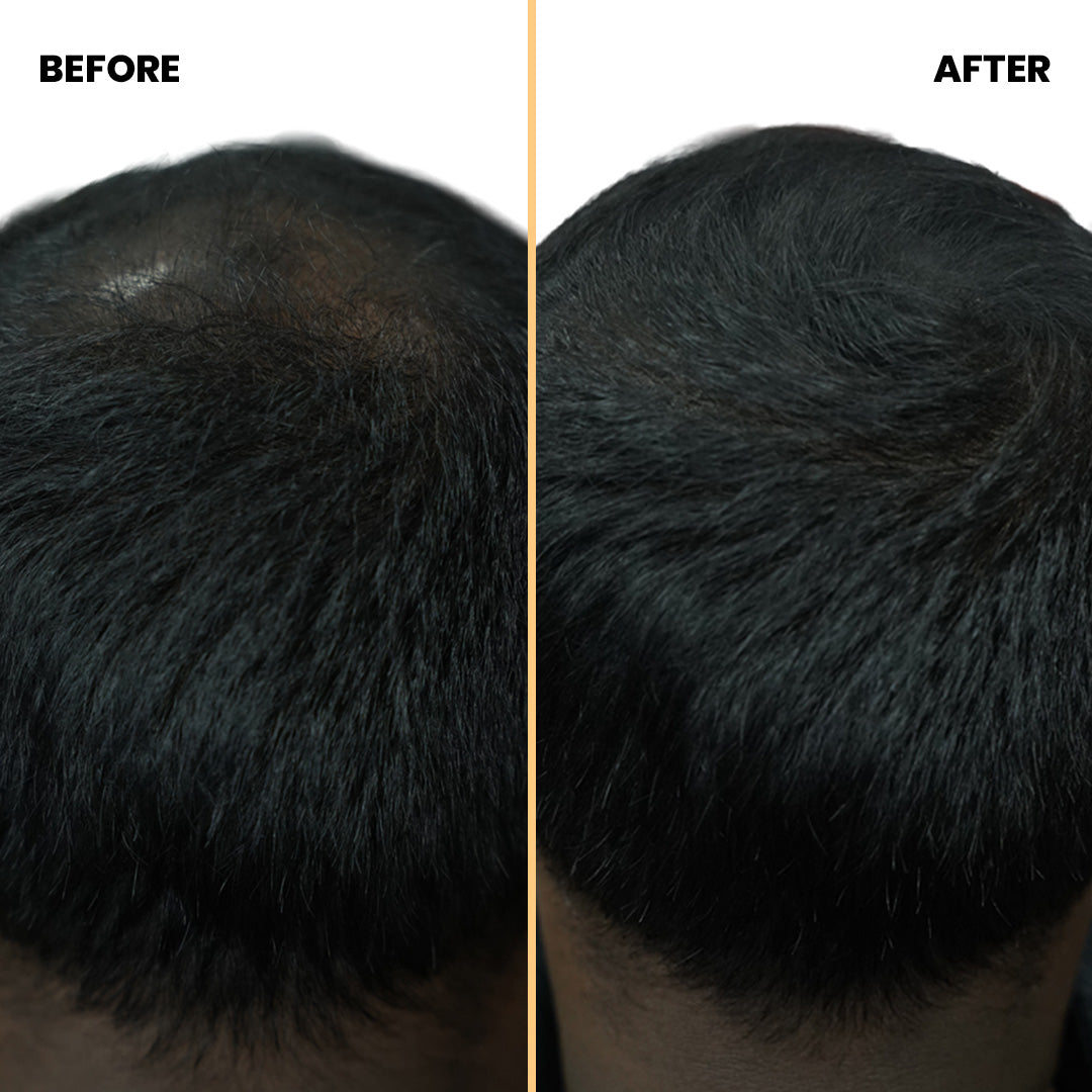 Instant Bald Fixing Powder | Covers Thin Hairs & Patchy Areas in 5 Seconds